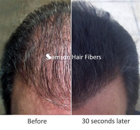 Hair Fiber Before After | ubicaciondepersonas.cdmx.gob.mx