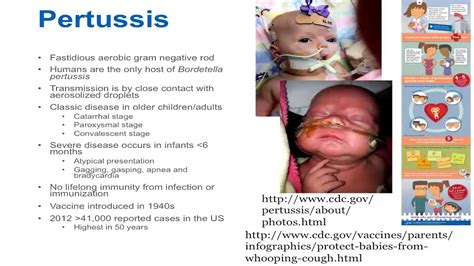 Pertussis- Epidemiology and Clinical Presentation - YouTube