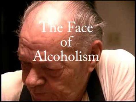 Face of Alcoholism - YouTube