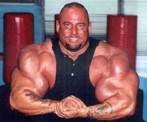 Synthol Gone Wrong : r/bodybuilding