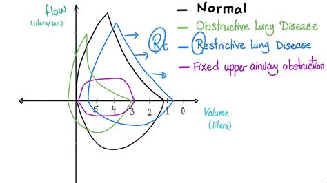 Flow Volume Loops - Respiratory Physiology - Pulmonary Medicine ...