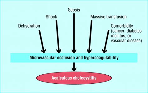 Acute cholecystitis | The BMJ