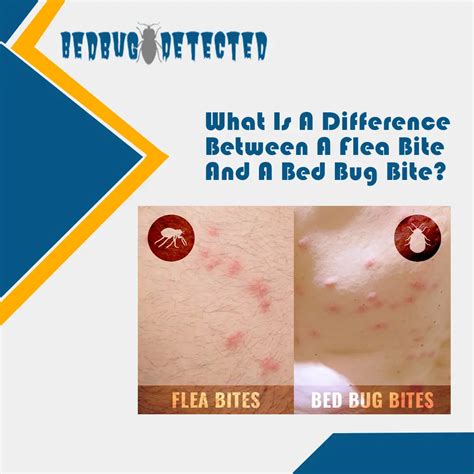 Bed Bugs vs Fleas | Difference Between flea bite and beg bite