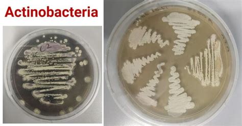 What are Actinobacteria? An Overview on Actinomycetes