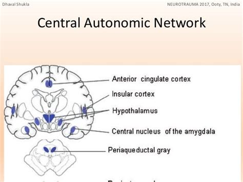 Paroxysmal Sympathetic Hyperactivity in Traumatic Brain Injury [PSH i…