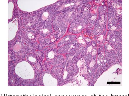 [PDF] Apocrine Sweat Gland Ductal Adenoma with Sebaceous Differentiation in a Dog | Semantic Scholar