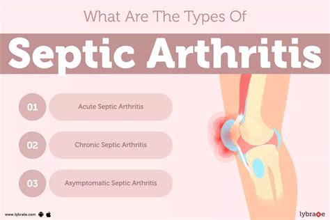 Septic Arthritis: Causes, Symptoms, Treatment and Cost