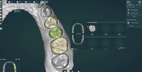 UPCAD Dental CAD Design Software - Up3D | Meditrust