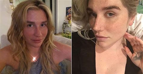 Photos of Kesha With No Makeup | POPSUGAR Beauty UK