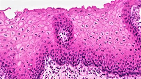 Simple Squamous Epithelium Slide Labeled