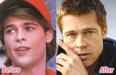 Brad Pitt Plastic Surgery Before and After Facelift and Nose Jobs (Star ...