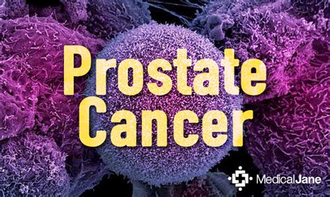 Treating Prostate Cancer with Medical Marijuana