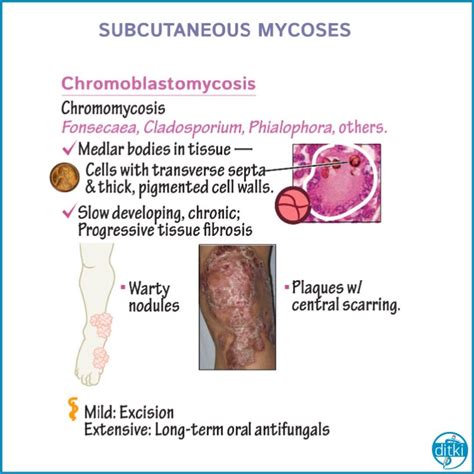 Get a high-yield review of #subcutaneous #mycoses in our Microbiology Course! #microbiology # ...