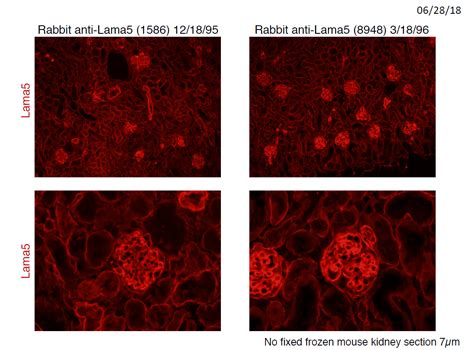 Rabbit-Anti-Mouse Laminin Alpha5 Antibodies - Kerafast