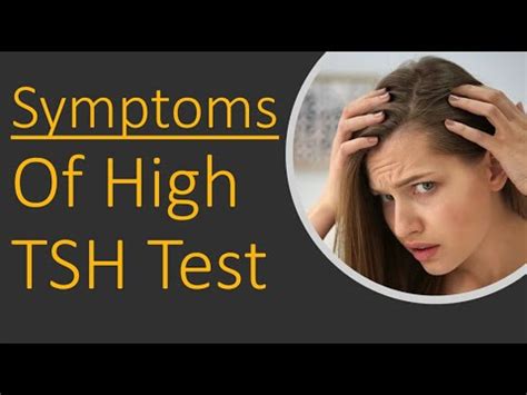 Symptoms of High TSH - YouTube