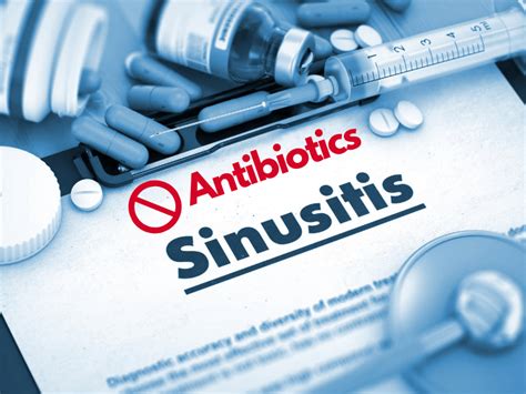 What Are the Best Antibiotics for Sinus Infection? - Flash Uganda Media