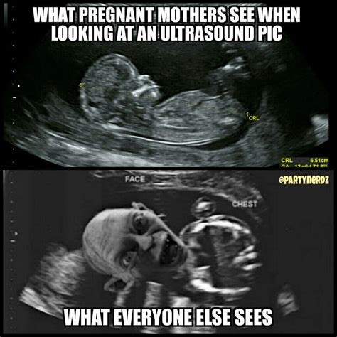 Download Funny Gollum Ultrasound Pictures | Wallpapers.com