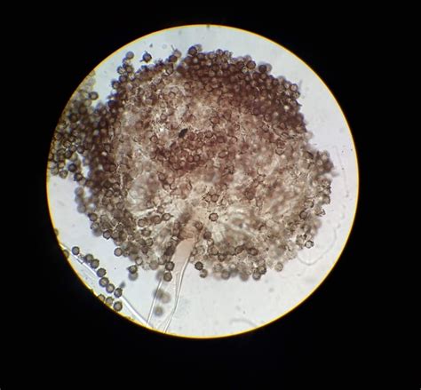 aspergillus brasiliensis with cotton blue dye, looking it's Sunday best ...