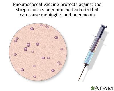 Pneumococcal polysaccharide vaccine | UF Health, University of Florida Health