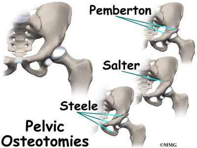 Patient Education | Concord Orthopaedics