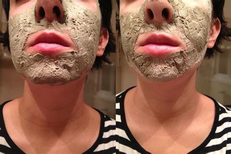 A Simple Homemade Mask for Acne (That Actually Works) - Bellatory