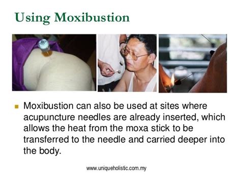 Moxibustion & Its Health Benefits