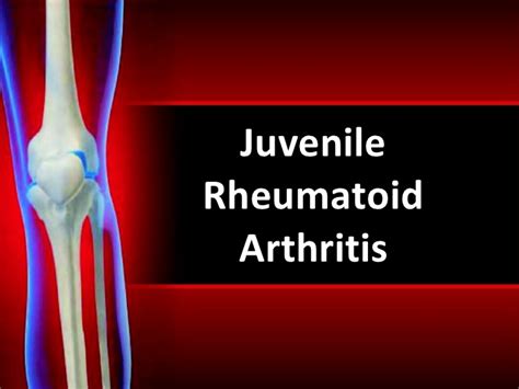 Juvenile Arthritis