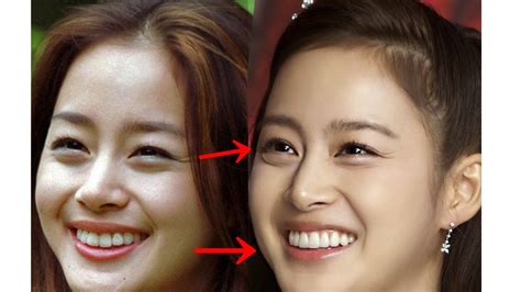 Kim Tae Hee Plastic Surgery | Kim Tae Hee Plastic Surgery Before And ...