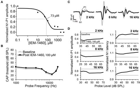 Auditory nerve compound action potential (CAP) measurements before and... | Download Scientific ...