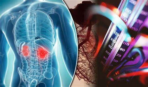 High blood pressure could be causing hidden chronic kidney disease | Health | Life & Style ...