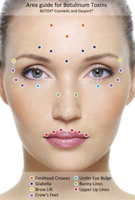 Botox injection sites, Botox fillers, Botox injections