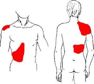 Gallbladder Pain - Location, Causes and Treatment