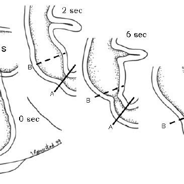 Roles of cholecystokinin (CCK) in digestion. Compiled from sources in ...