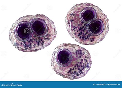 Cytomegalovirus CMV In Human Cell, Owl's Eye Inclusion In Nucleus Stock ...