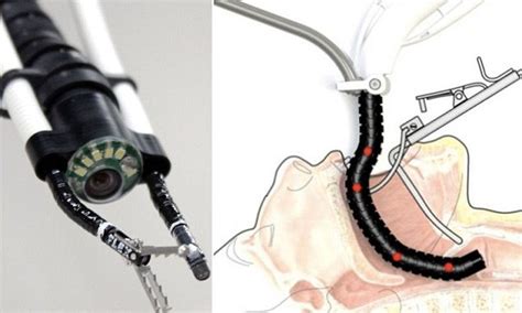 Flex System 'robotic snake' performs surgery inside your body | Daily ...