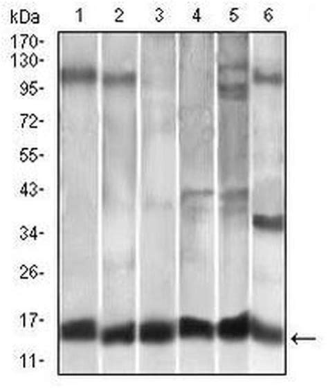 MCP-1 Monoclonal Antibody (2D8) (MA5-17040)