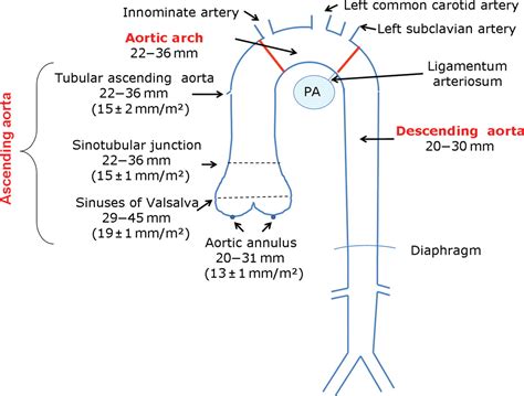 EchoTalk blog agora é echotalkblog.com: Aorta by European "DIC"