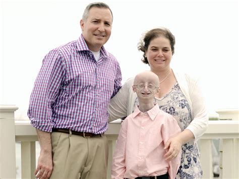 Sam Berns: Funeral held for inspirational teenager with an ageing disorder