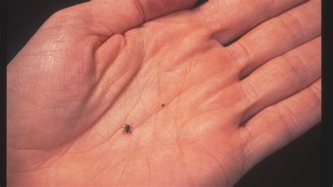 What Are Seed Ticks? Parents Should Be On The Lookout This Summer