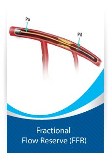 Fractional Flow Reserve (FFR) - Shri Krishnasai Clinic