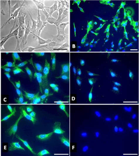 Characterization of human Schwann cells in primary culture. Morphology... | Download Scientific ...