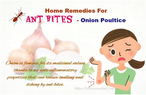 29 Home Remedies For Ant Bites And Stings Swelling & Itching