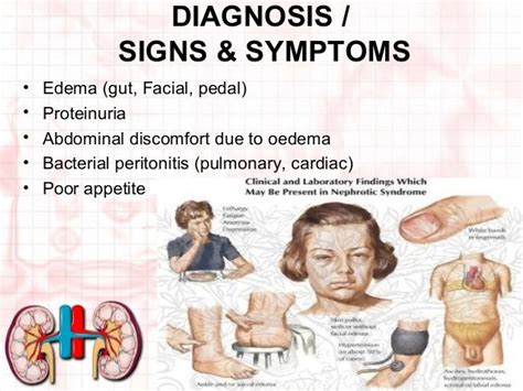 Signs And Symptoms Of Nephrotic Syndrome