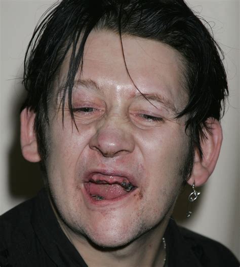 Shane MacGowan in 2015 – The Pogues singer has brand new teeth | Metro News