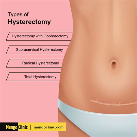 Weight Loss after a Hysterectomy and Its Side Effects? · Mango Clinic