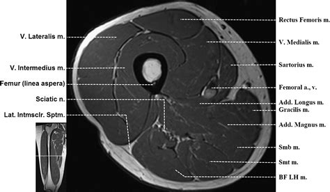 Normal MR Imaging Anatomy of the Thigh and Leg - Magnetic Resonance Imaging Clinics