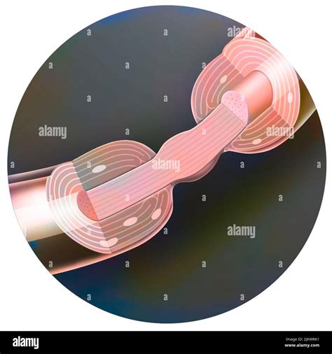 Schwann cell axons hi-res stock photography and images - Alamy