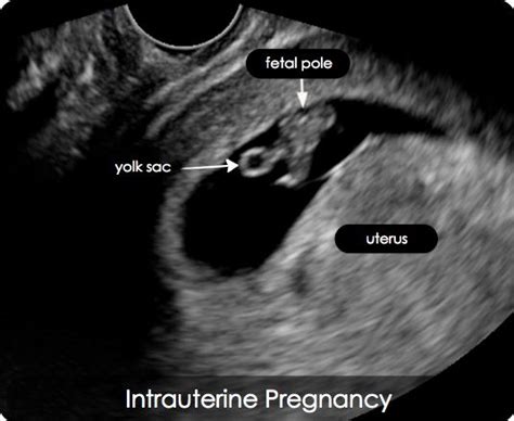 17 Best images about sonography on Pinterest | Medical students, First ...