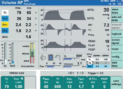 MV (MECHANICAL VENTILATOR) SETTINGS,MAKE EASY Positive End Expiratory ...