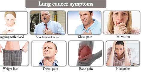 Symptoms of Lung Cancer on Different Stages - CancerOz